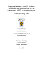 Interplay between the p53 isoform, Δ133p53, and interleukin-6 signal transducer, IL6ST in prostate cancer