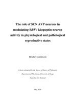 The role of SCN AVP neurons in modulating RP3V kisspeptin neuron activity in physiological and pathological reproductive states