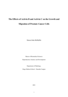 The Effects of Activin B and Activin C on the Growth and Migration of Prostate Cancer Cells