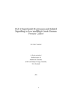 TGF-β Superfamily Expression and Related Signalling in Low and High Grade Human Prostate Cancer