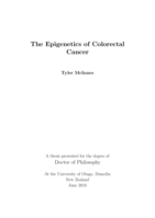The Epigenetics of Colorectal Cancer