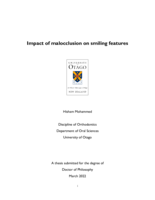 Impact of malocclusion on smiling features