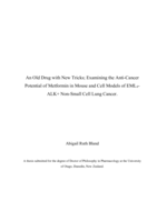 An old drug with new tricks; examining the anti-cancer potential of metformin in mouse and cell models of EML4- ALK+ non-small cell lung cancer