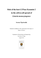 Role of the host GTPase Dynamin 2 in the cell-to-cell spread of Listeria monocytogenes