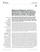 Missense Pathogenic variants in KIF4A Affect Dental Morphogenesis Resulting in X-linked Taurodontism, Microdontia and Dens-Invaginatus
