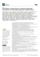 MuscleMap: An Open-Source, Community-Supported Consortium for Whole-Body Quantitative MRI of Muscle