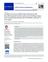 Treatment of severe skeletal Class III patient with buccally impacted canines and severe crowding using a bone-anchored facemask and Alt-RAMEC protocol: A case report