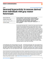 Neuronal hyperactivity in neurons derived from individuals with gray matter heterotopia