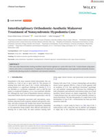 Interdisciplinary Orthodontic‐Aesthetic Makeover Treatment of Nonsyndromic Hypodontia Case