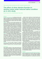 The effect of silver diamine fluoride on dentine caries under reduced saliva condition: an in vitro study