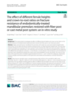 The effect of different ferrule heights and crown-to-root ratios on fracture resistance of endodontically-treated mandibular premolars restored with fiber post or cast metal post system: an in vitro study
