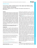 Uncovering mitotic ultrastructure in the native hair follicle using volume electron microscopy