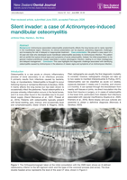 Silent invader: a case of Actinomyces-induced mandibular osteomyelitis