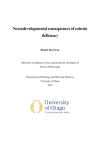 Neurodevelopmental consequences of cohesin deficiency